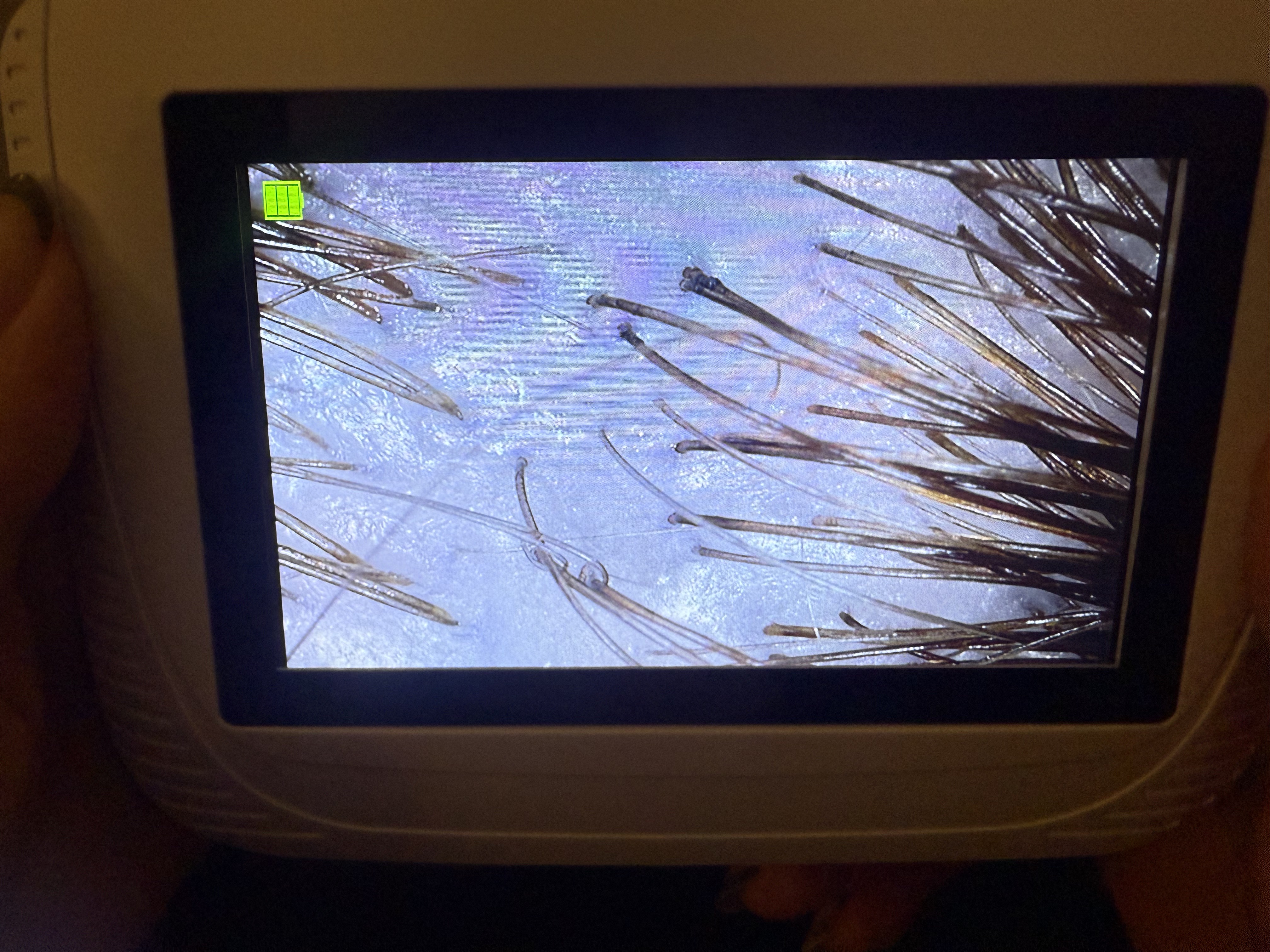 Detailed scalp analysis technology